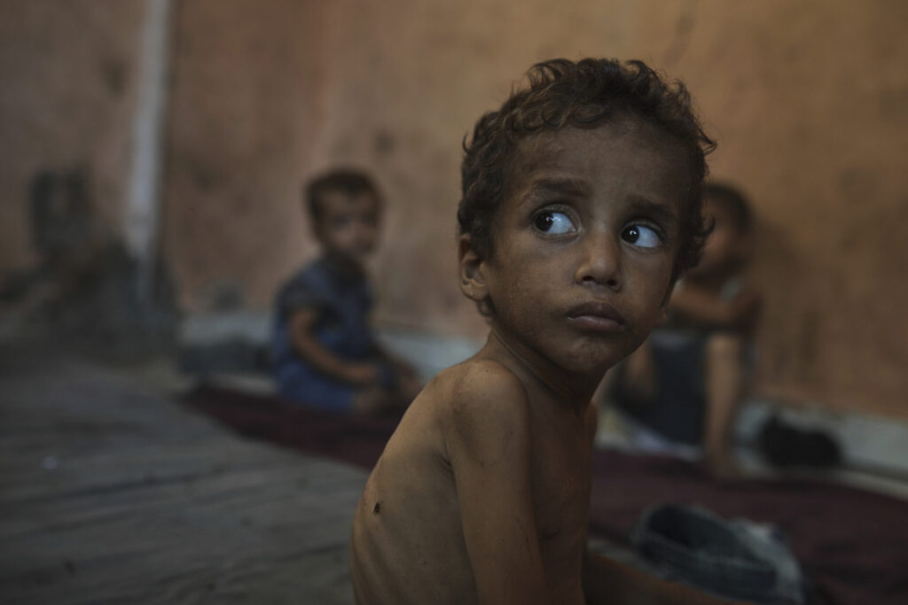 La hambruna provocada por el bloqueo israelí condena a Gaza a otra batalla contrarreloj, ésta para salvar vidas: "El deseo de mi vida es poder darles pan a mis hijos"